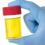 Peneliti Ungkap Kenapa Urine Berwarna Kuning dan Berbau Amonia