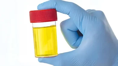 Peneliti Ungkap Kenapa Urine Berwarna Kuning dan Berbau Amonia
